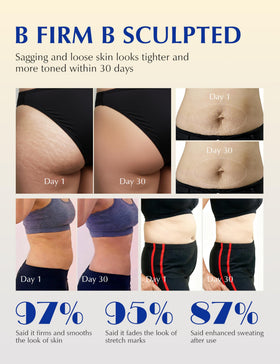 EXPRESSIONS WELLNESS Skin Tightening Cellulite Cream application on skin