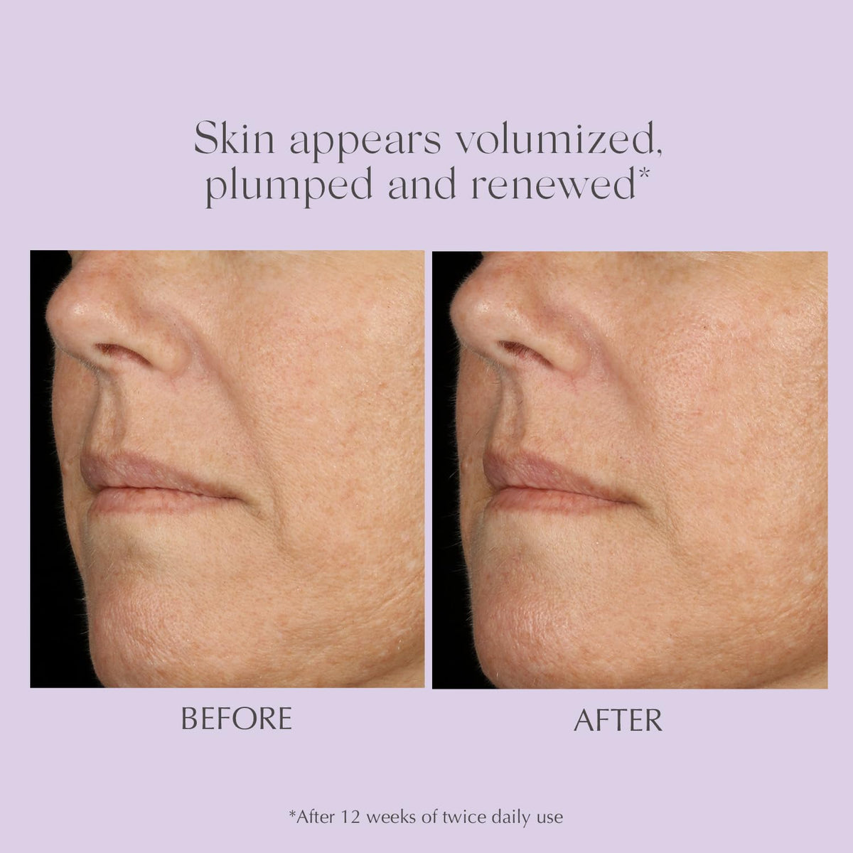 EXUVIANCE AGE REVERSE+ serum in lifestyle setting