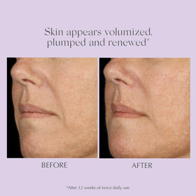 EXUVIANCE AGE REVERSE+ serum in lifestyle setting