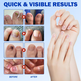 FANSHI Nail Patches 21 PCS lifestyle scene with nails