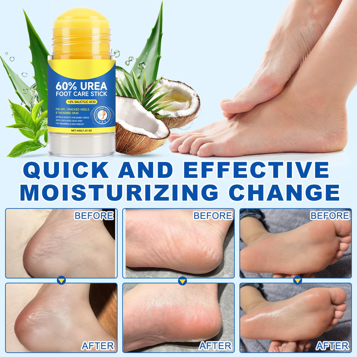 FANSHI Urea Stick 60% in a lifestyle setting