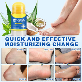 FANSHI Urea Stick 60% in a lifestyle setting