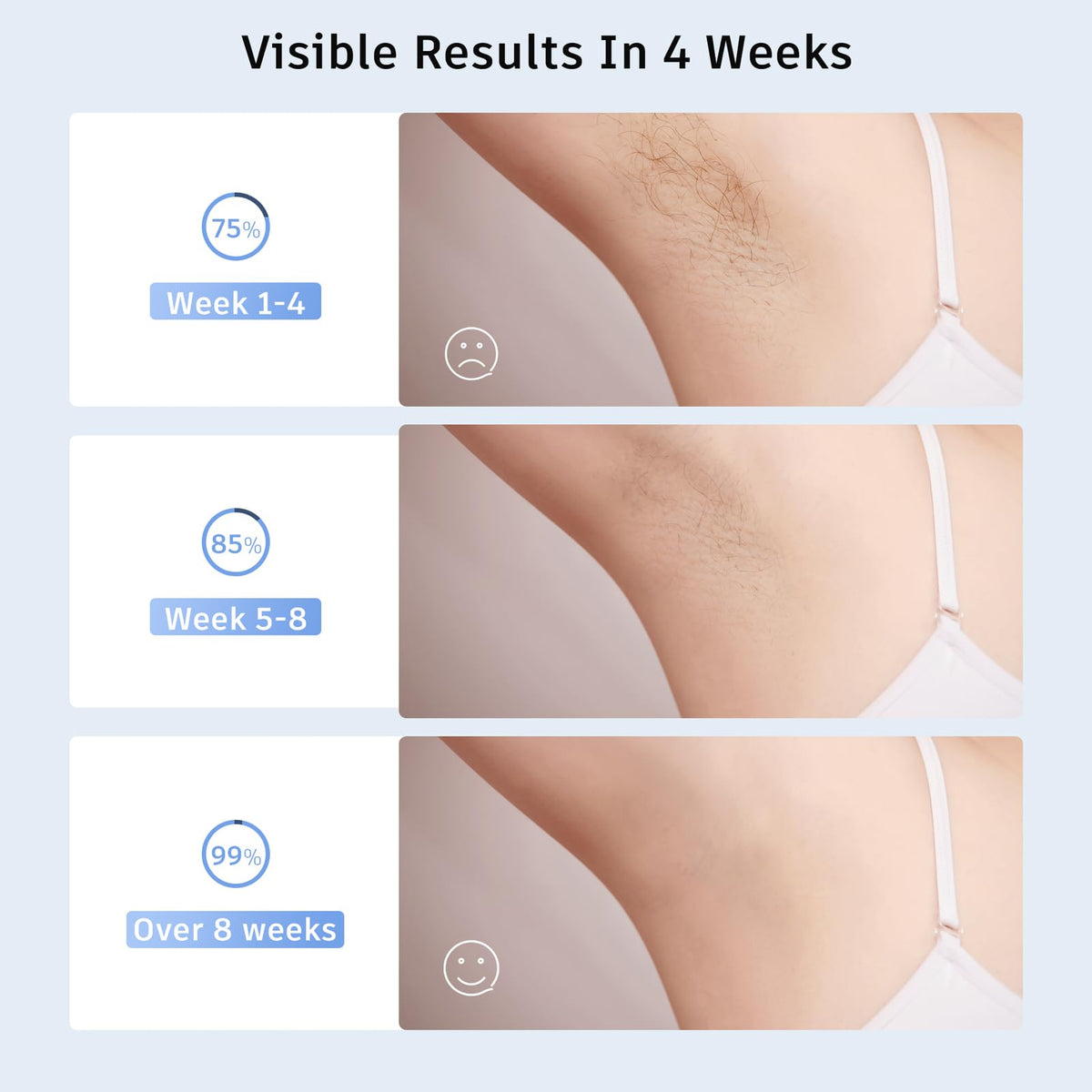 Finequin Laser Hair Removal Device with protective eyewear