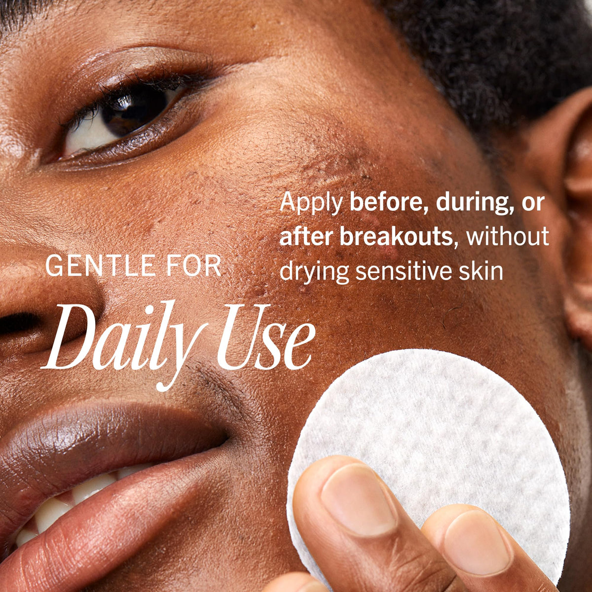 First Aid Beauty Acne Pads ingredients list