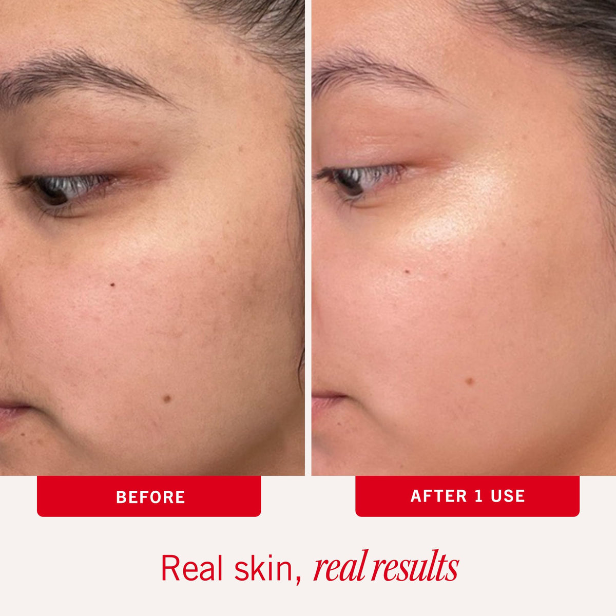 First Aid Beauty Facial Radiance Pads with lid open
