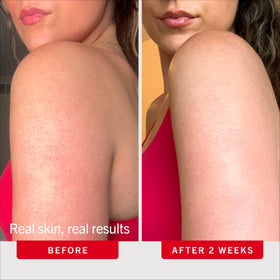 First Aid Beauty KP Bump Eraser Body Scrub application on skin