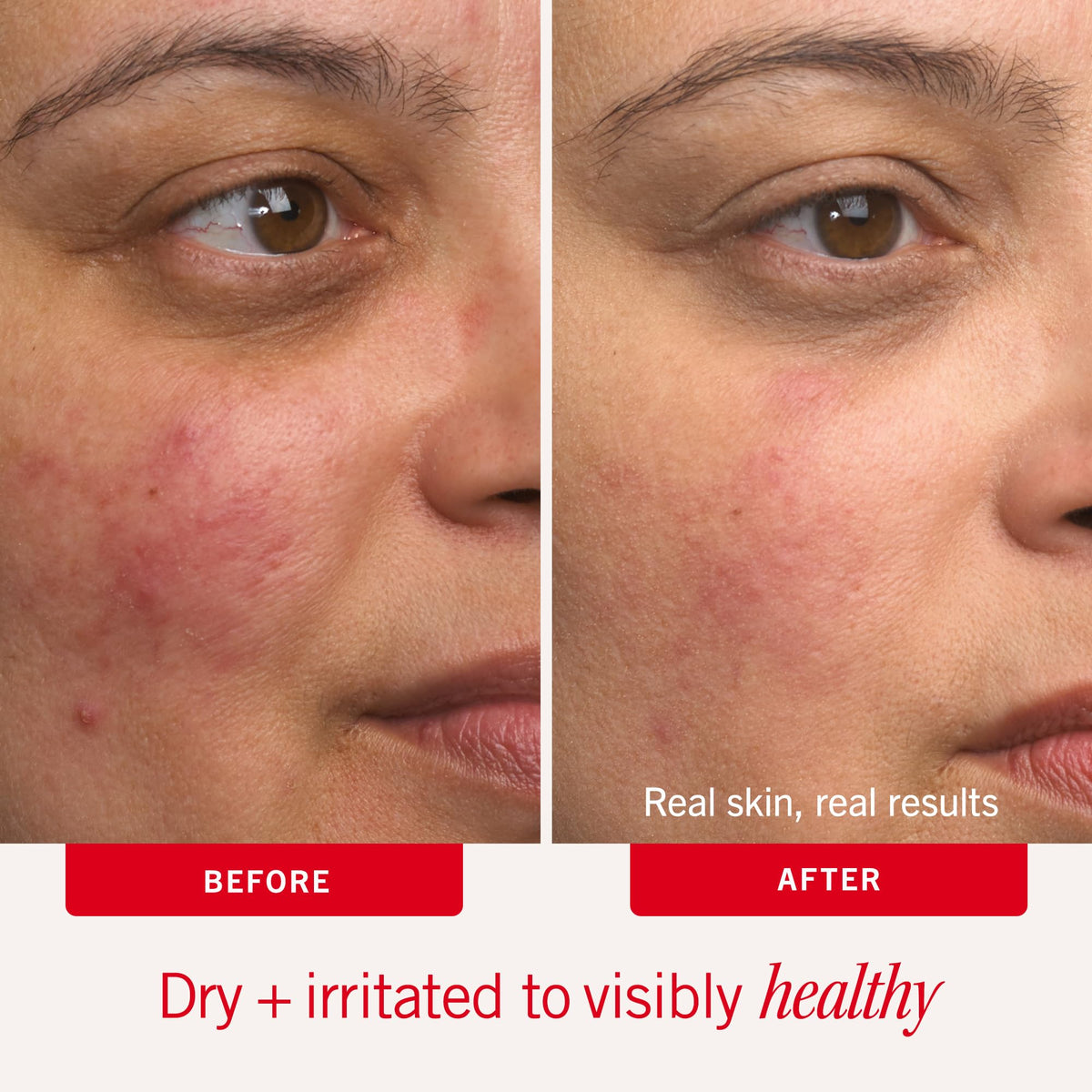 First Aid Beauty Ultra Repair Cream texture close-up