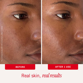 First Aid Beauty Ultra Repair Hydrating Pillow Pads in use on a model's face