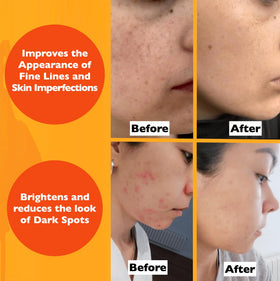 Florence Vitamin C Serum with botanical ingredients