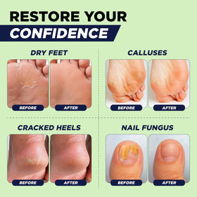 FOOT Tea Tree Oil Muscle Foot Soak lifestyle scene with feet in water