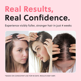 Forchics Hair Growth Serum 50ml application on scalp