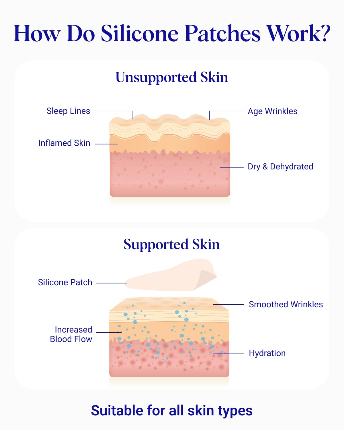 Forehead Wrinkle Patches 2 pack by Wrinkles Schminkles
