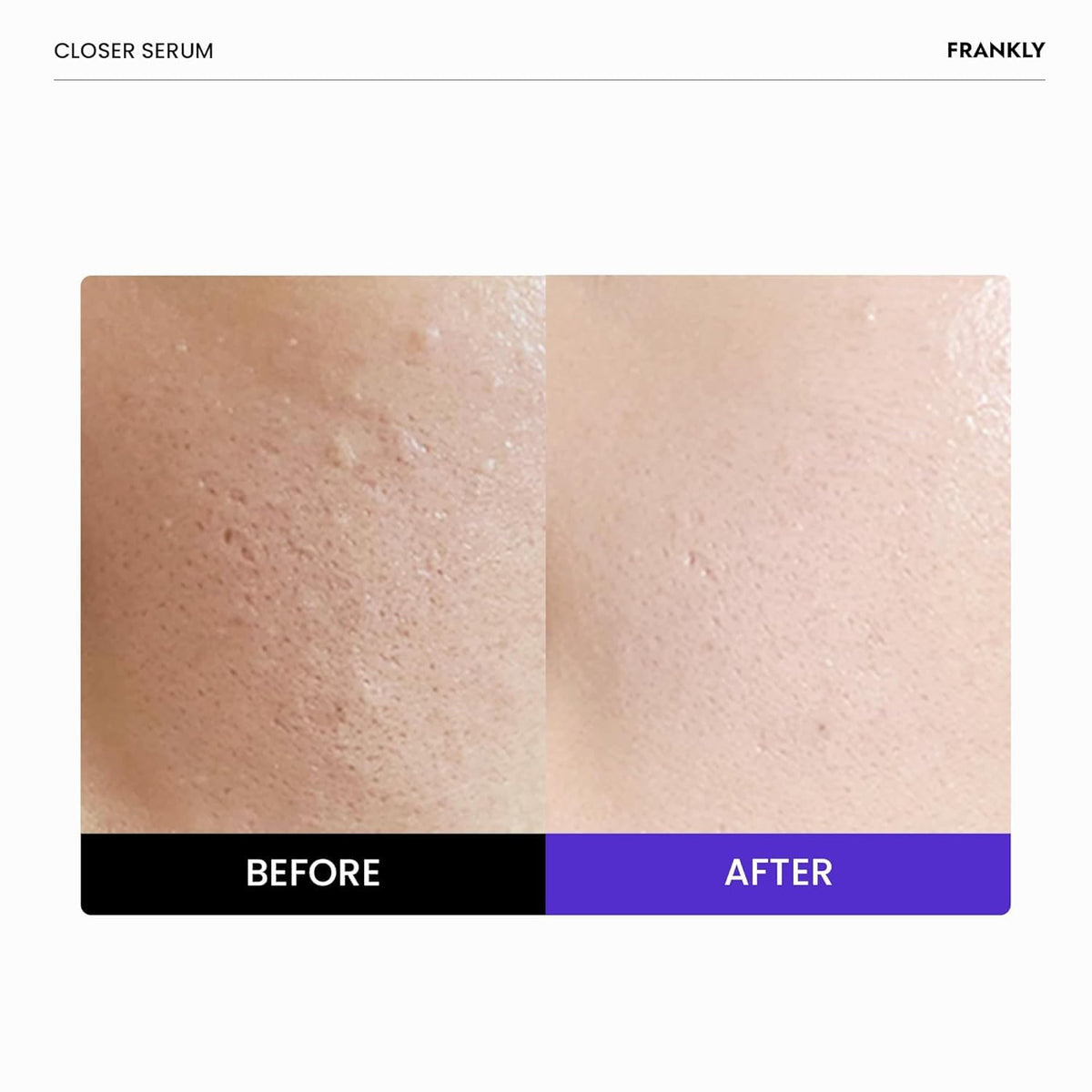 FRANKLY Closer Serum Jumbo side view showing packaging details