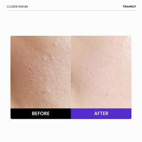 FRANKLY Closer Serum Mega Jumbo 3.38 fl oz back view