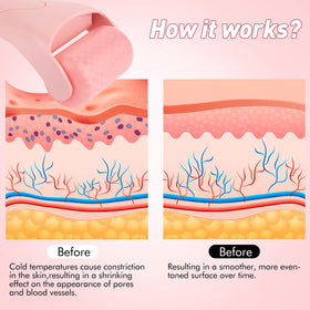 Fronnor Ice Roller in use on a woman's face