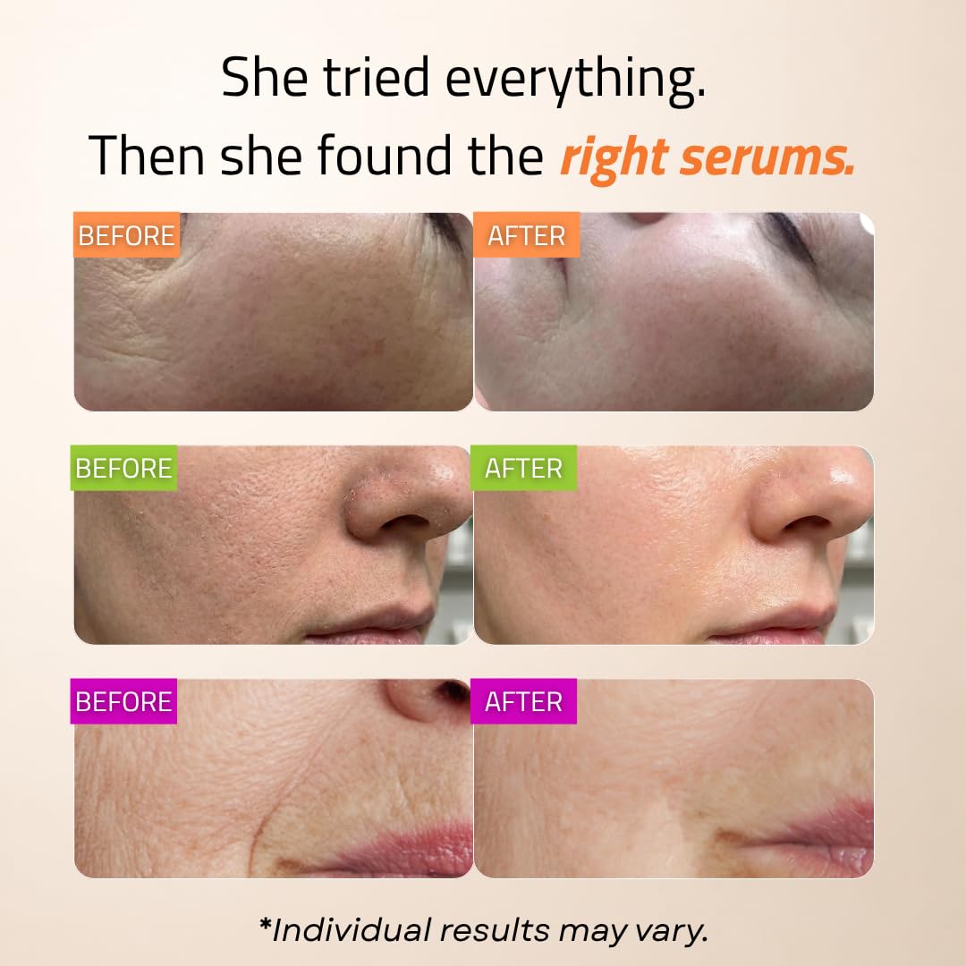 Front view of GLEOW Hyaluronic Acid Serum bottle