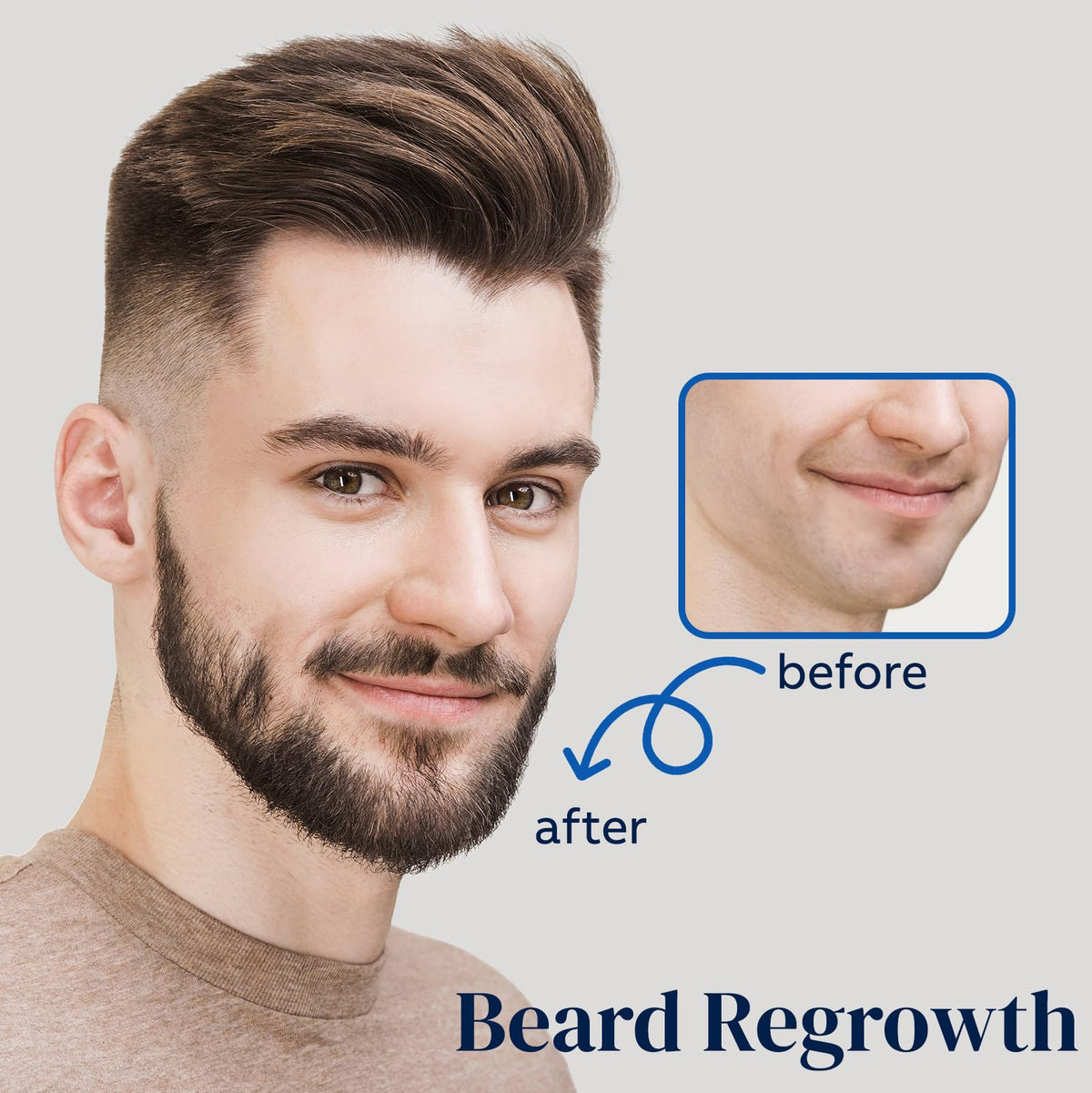 FUZYAT 5% Minoxidil Hair Growth Spray side view