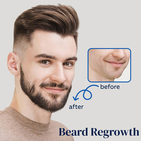 FUZYAT 5% Minoxidil Hair Growth Spray side view