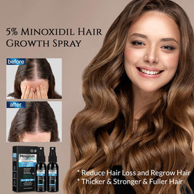 FUZYAT 5% Minoxidil Hair Growth Spray with Biotin & Castor Oil ingredients