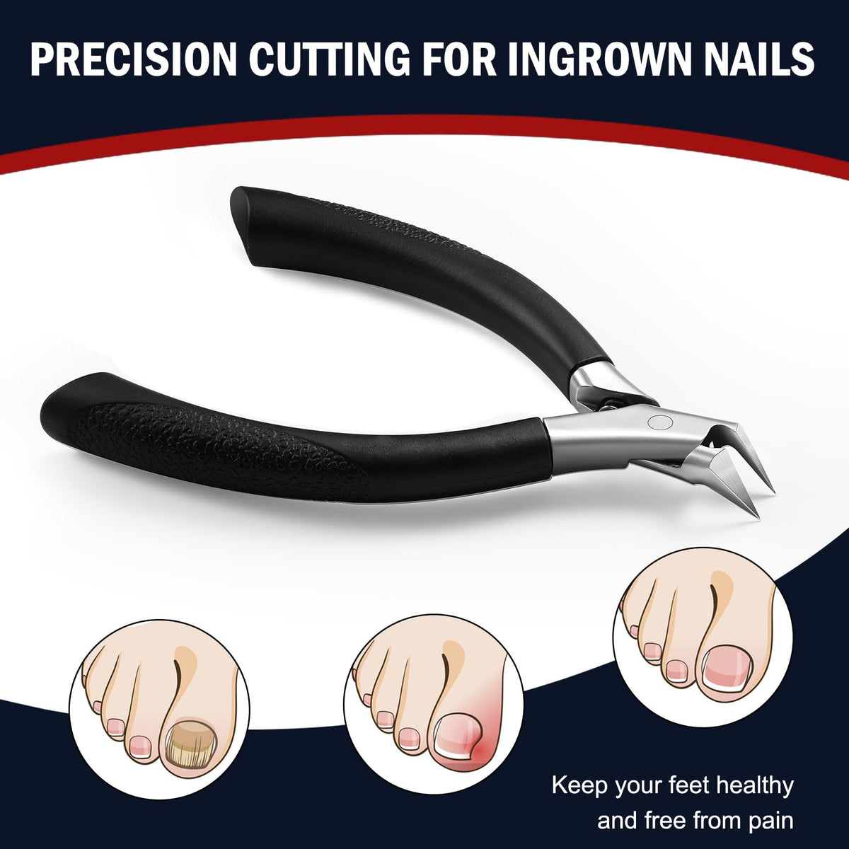 FVION Toenail Clippers close-up of sharp blades