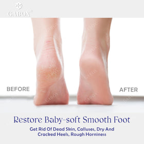 GABOX foot file demonstrating wet rubbing technique