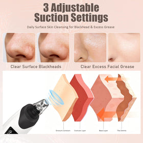 Gackoko Blackhead Remover Pore Vacuum display screen