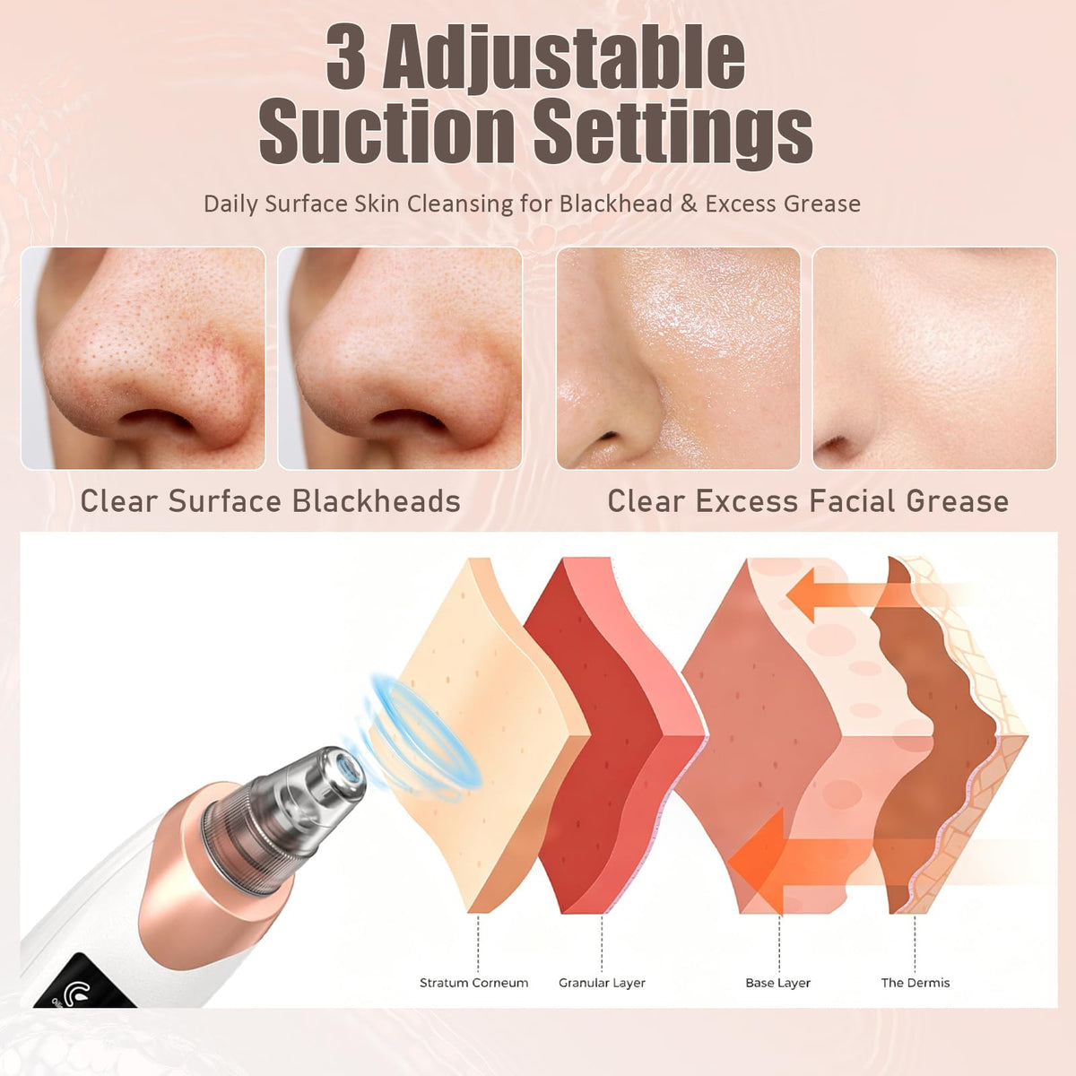 Gackoko Blackhead Remover Pore Vacuum showing USB charging port