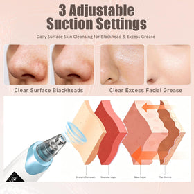 Gackoko Blackhead Remover Pore Vacuum side view