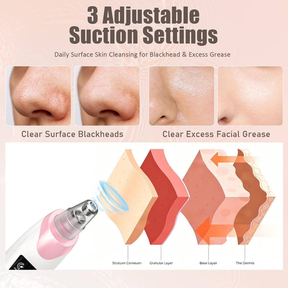 Gackoko Blackhead Remover Pore Vacuum with probes laid out on a surface
