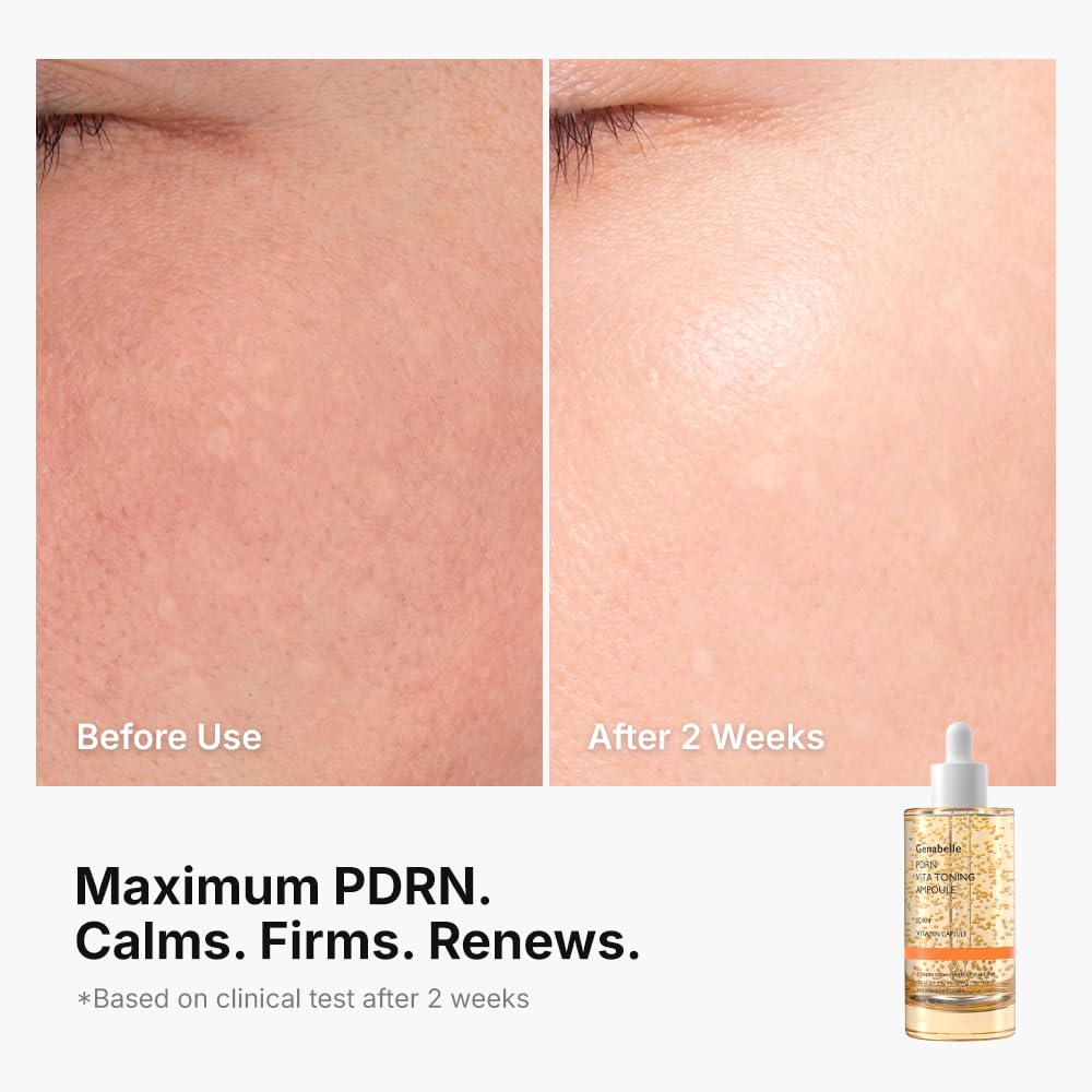 Genabelle PDRN Vitamin C Serum texture on hand