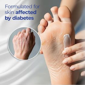 Goicoechea Diabet TX Diabetic Lotion application on skin