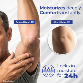 Goicoechea Diabet TX Diabetic Lotion texture close-up