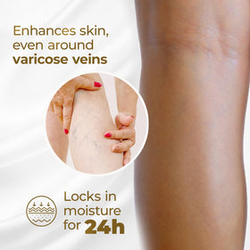 Goicoechea Varicose Veins Cream application on legs