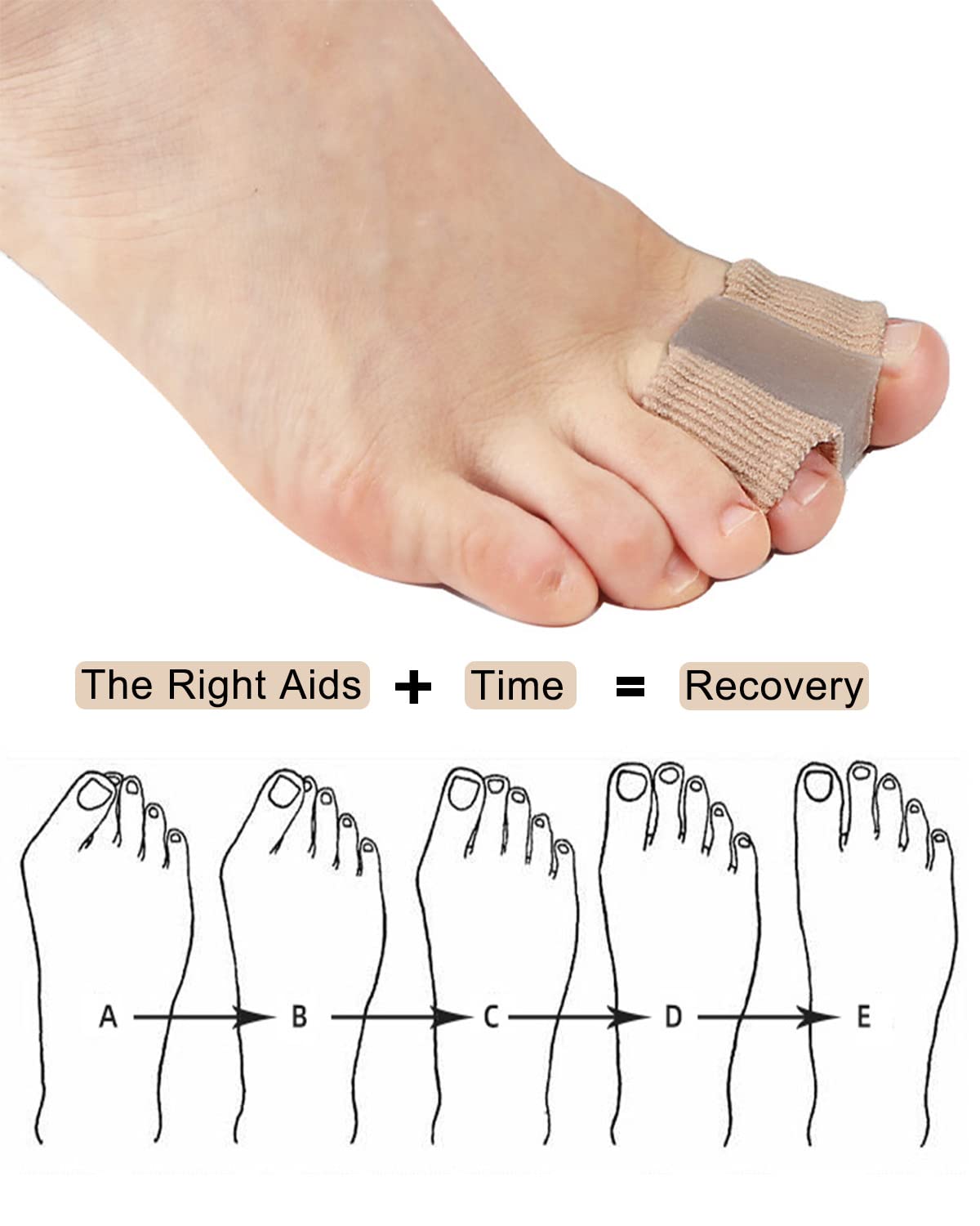 Golbylicc Bunion Toe Separators side view with packaging