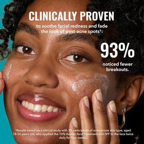 Good Molecules 10% Azelaic Acid texture on hand