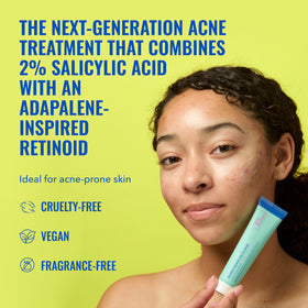 Good Molecules Acne Gel Cream tube with cap off