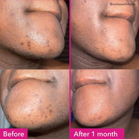 Good Molecules Brightening & Dark Spots Bar side view
