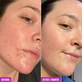 Good Molecules Clarify and Cleanse Bar with ingredients displayed