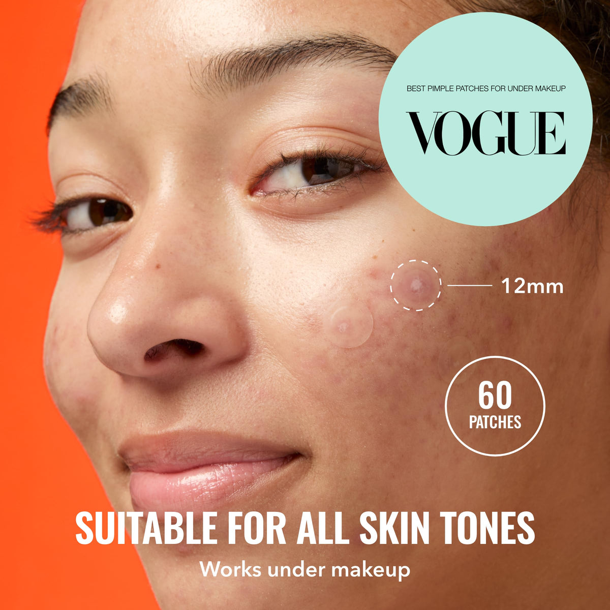Good Molecules Pimple Patches in use on a face