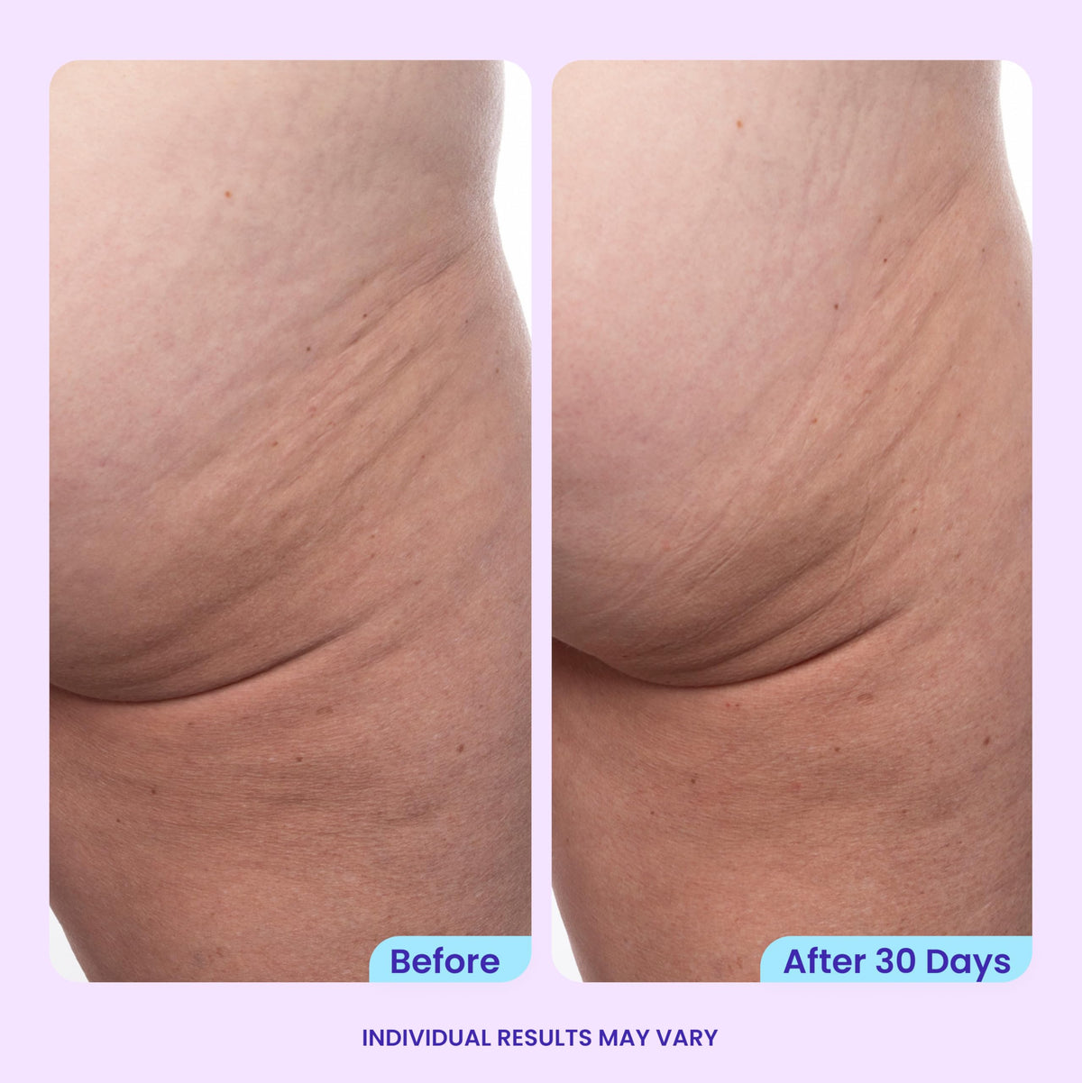 goPure Firming Butt & Thigh Cream in lifestyle setting