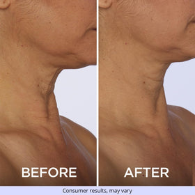 goPure Neck & Chest Moisturiser Cream with other skincare products