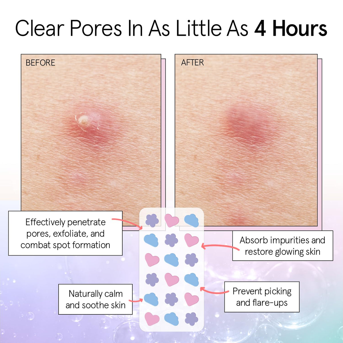 grace & stella Pimple Patches blue cloud design packaging