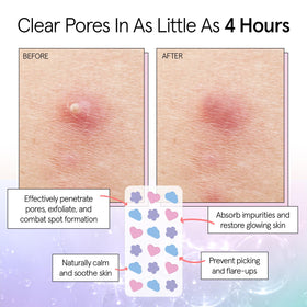 grace & stella pimple patches on skin demonstrating invisibility