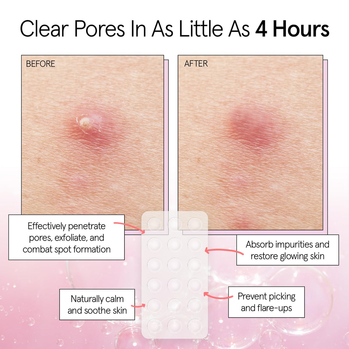 grace & stella pimple patches pack with 72 patches