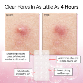 grace & stella pimple patches pack with 72 patches
