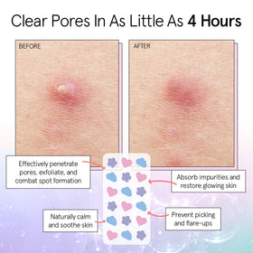 grace & stella Pore Strip Pimple Patches close-up of heart-shaped patches