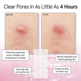 grace & stella Pore Strips showing individual acne patches