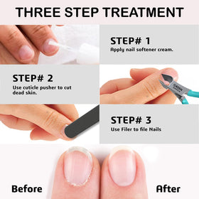 GREEN ESTETICA cuticle nipper in use on nails
