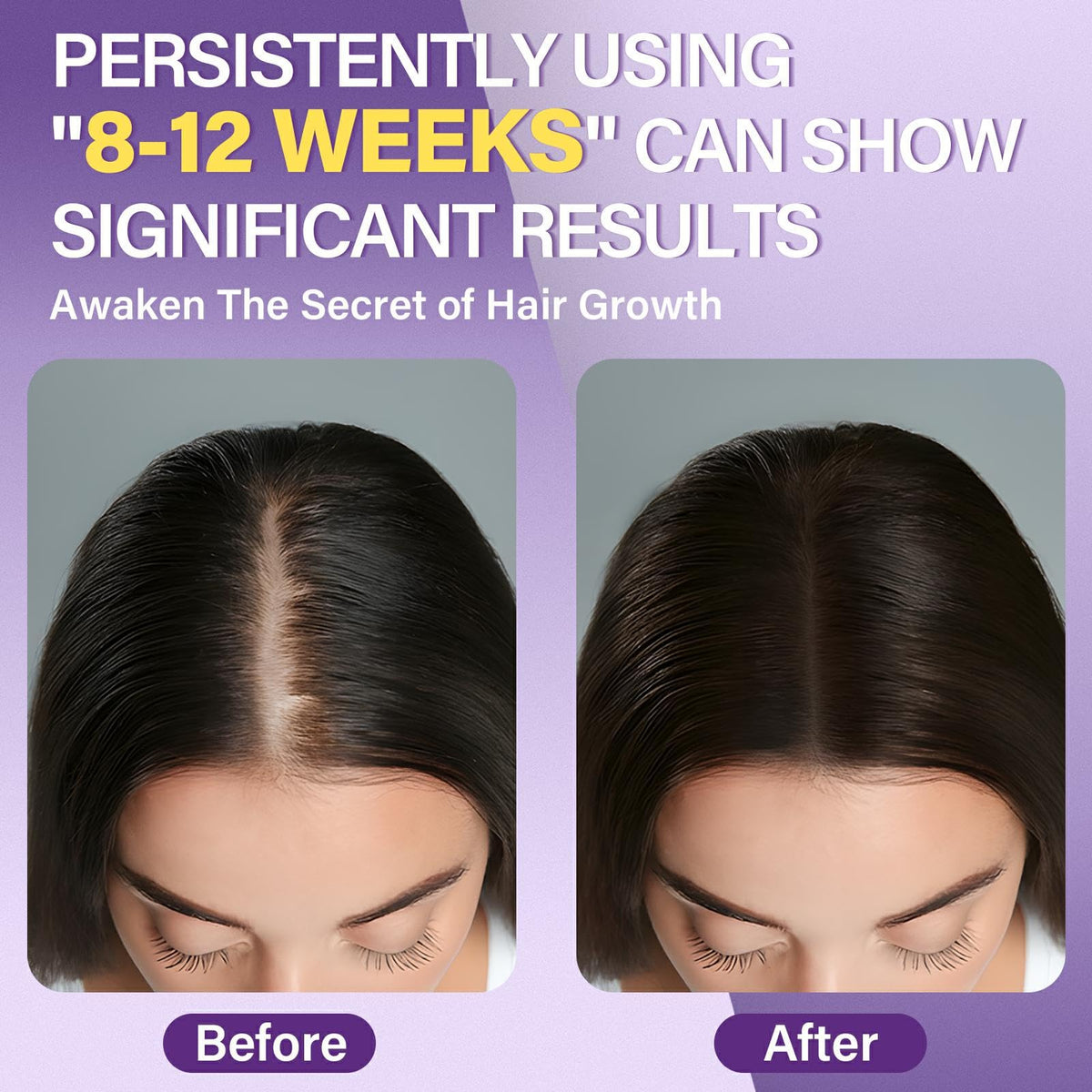 Greoay Minoxidil Foam bottle side view showing dosage pump