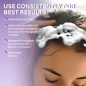 Greoay Minoxidil Foam showing ingredients list on packaging